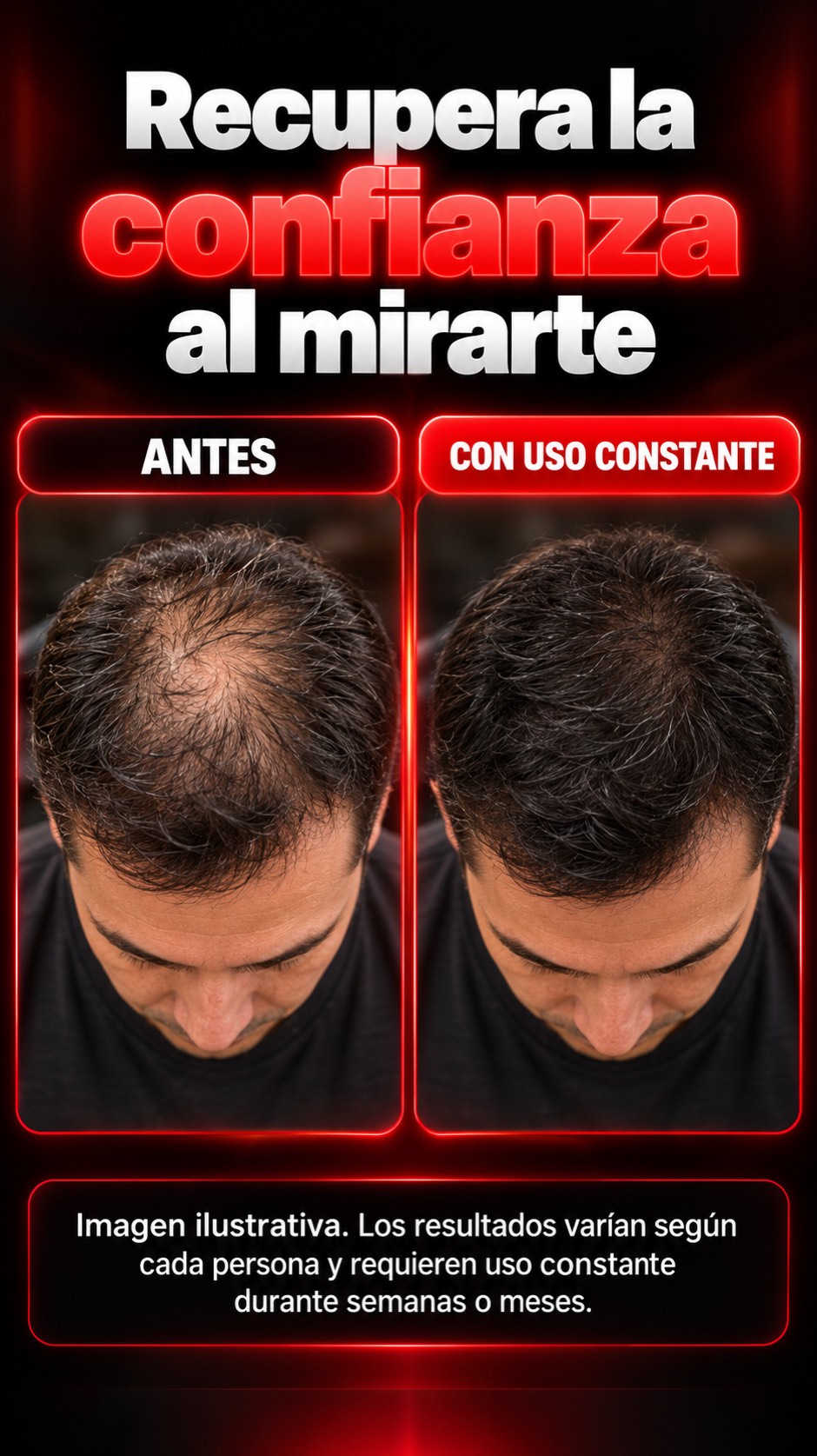 Gorra Capilar con Luz Infrarroja
